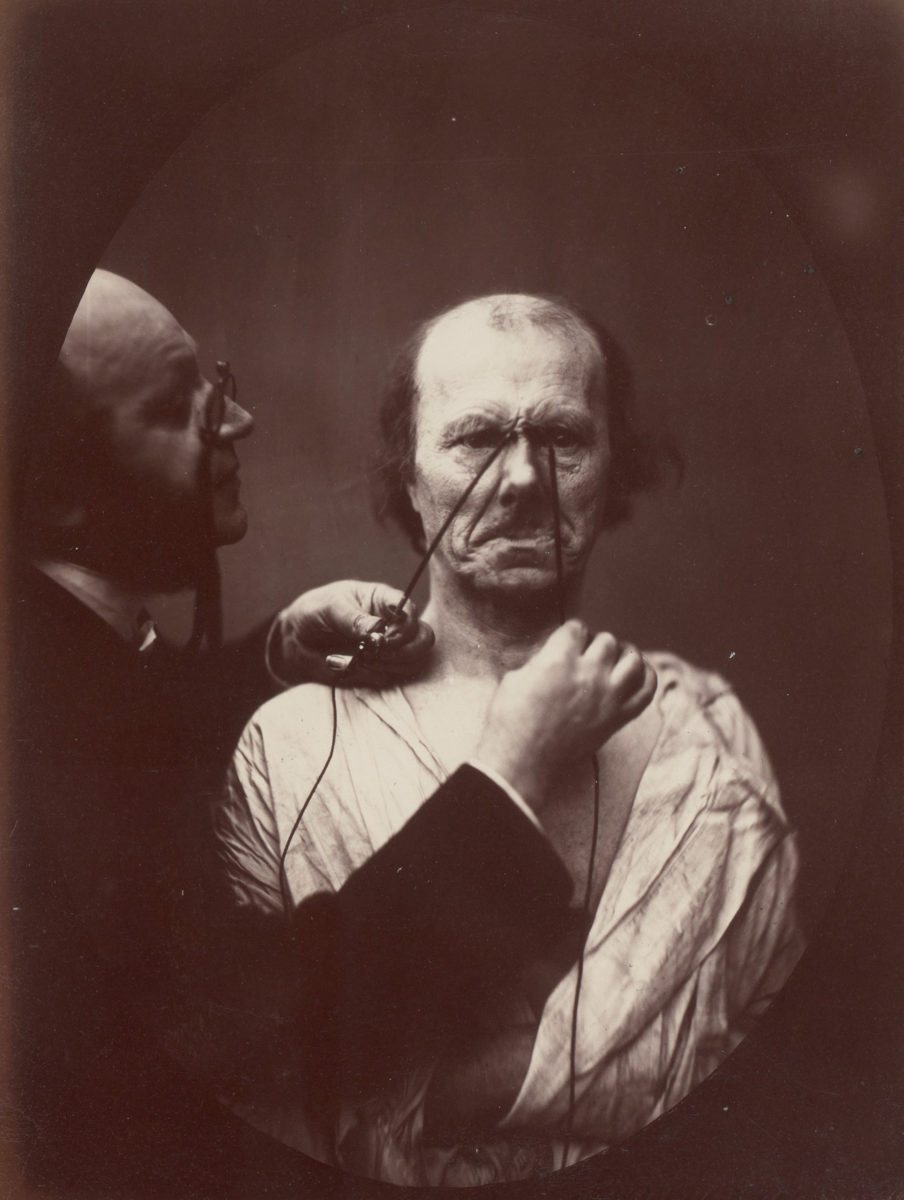 Duchenne de Boulogne,
Study from ‘The Mechanism of Human Facial Expression’ 18’,
1856-57 with Robert Hershkowitz