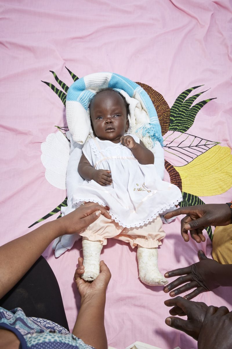 Sophia Mohammed (hands bottom left), a community rehabilitation expert with Light For The World, shows Zaina Simon (hands bottom right), mother of 4 month old Hadia, a new physiotherapy technique, Mundri, South Sudan, 2018.
Hadia was born with multible disablities, including  hydrocephalus, spinal bifida and clubfoot.